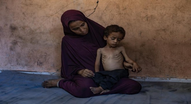 Gazze’de açlıktan ölenlerin sayısı 113’e yükseldi